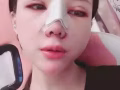 網紅鼻的時尚元素/台灣隆鼻