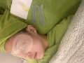 眼睛刮痧