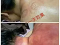 排湿排寒