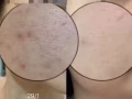 你还在每天花时间上底妆？素颜不可能？暗沉、痘痘、皱纹一套产品让你解决所有问题