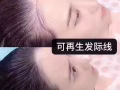 安全有效生发