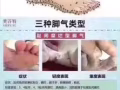 美浮特产品从头皮到脚趾呵护您的皮肤问题