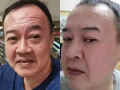 特價豪華臉部護理