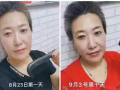 东施帛健康养生梳子募集新加坡和中国的市场前期合作伙伴