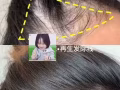 生髮技術