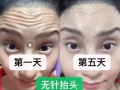 微整祛皱提升填充溶脂隆鼻嘟嘟唇丰下巴全岛低价服务好