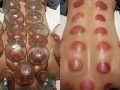 spa按摩送刮痧拔罐