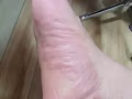消除一切皮肤病