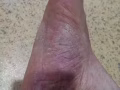 消除一切皮肤病