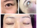 新加坡正规整形老店👩💃 🏥 81萾YlNG国际贸易 💉医疗美容抗衰减肥 