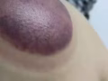 按摩拔罐