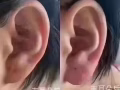 微整大特价