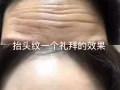 微整大特价