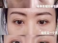 医美微调