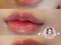 微整 买就送 瘦脸.瘦腿.瘦肩.小脸针.水光针填充下巴