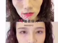 微整大優惠