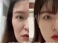 医美微整大优惠