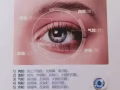 新加坡眼睛护理免费培训报名