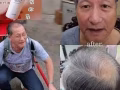 脱发救星⭐️生毛丹养发液