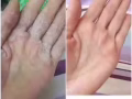 真菌王