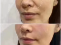 多年经验，专注于调整脸型，设计脸型，真正帮助顾客变美，不花多余的钱，追求高级脸