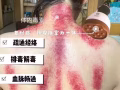 光波汗蒸+刮砂+碧波庭拔罐+艾灸