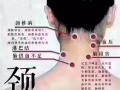 中医专业推拿