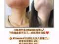 韩国优质多彩维他命C粉【帮助保护心脏，保护皮肤，防止衰老】