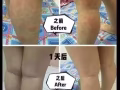 草本艾丹【舒缓皮肤不适症状，而且降低抑制坏菌，真的很好用】