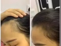 禿頭❓脫髮❓頭皮問題❓【純天然養發劑，天然不刺激，無副作用】
