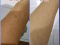 韓國專利技術配方√愛丹【清洗死角；污垢殘留、清潔不徹底會引發婦科炎症】