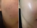轻医美水光除皱抗衰提升