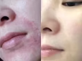 专业做斑，痘，敏/私密粉嫩