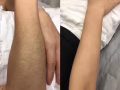 永久性永毛、胸部、手臂、腿部、腋下、比基尼、紋眉、紋唇