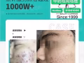 我是Carleen是專業祛斑痘黃修護的行家隨時聯絡Whatsapp81852768微信Carleen141319